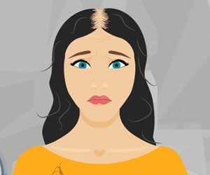 Hair Loss