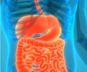 Inflammatory Bowel Disease