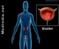 Interstitial Cystitis / Painful Bladder Syndrome Interstitial Cystitis / Painful Bladder Syndrome