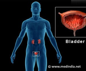 Interstitial Cystitis / Painful Bladder Syndrome