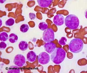 Leukemia / Blood Cancer