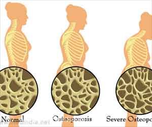 Top 10 Tips to Increase Bone Strength