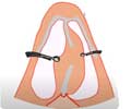 Septoplasty - Anatomy And Physiology