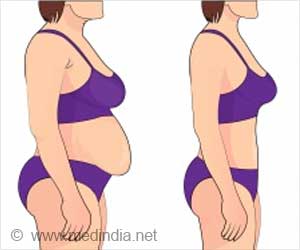 Breast Reduction Surgery-Symptoms-Indications-Preparation-Complications
