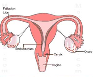 Dilatation and Curettage - Overview