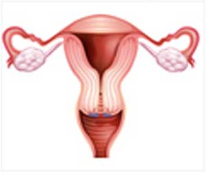 LEEP (Loop Electrosurgical Excision Procedure) - Indications, Preparation, Procedure, Recovery & Complications