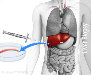 Liver Biopsy - Risks, Making Safe