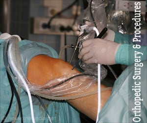 Orthopedic Surgery and Procedures