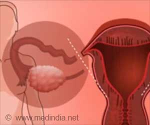 Oophorectomy