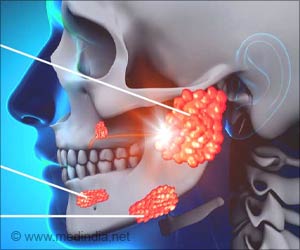 Parotidectomy - Indications Procedure Post-operative care, & Complications