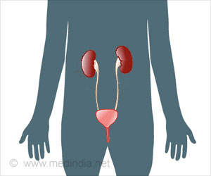 Percutaneous Nephrolithotomy (PCNL)