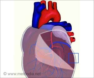Pericardiectomy - Indications, Preparation, Procedure, Recovery & Complications