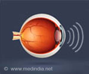 Photorefractive Keratectomy (PRK) - Surgical Procedure
