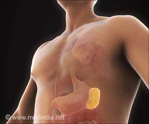 Splenectomy | Spleen Removal - Types, Indications and Complication