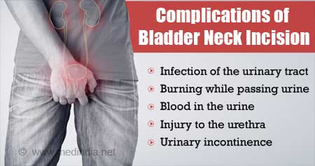 Bladder Neck Incision (B.N.I.) and Urethrotomy