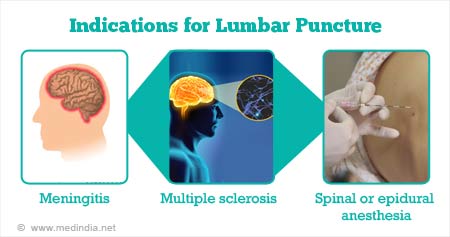 Lumbar Puncture (Spinal Tap) - Preparation, Indications, Procedure &  Complications