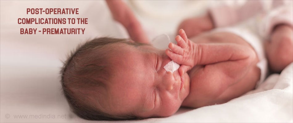 Post-operative Complications to the Baby - Prematurit Post-operative Complications to the Baby - Prematurit