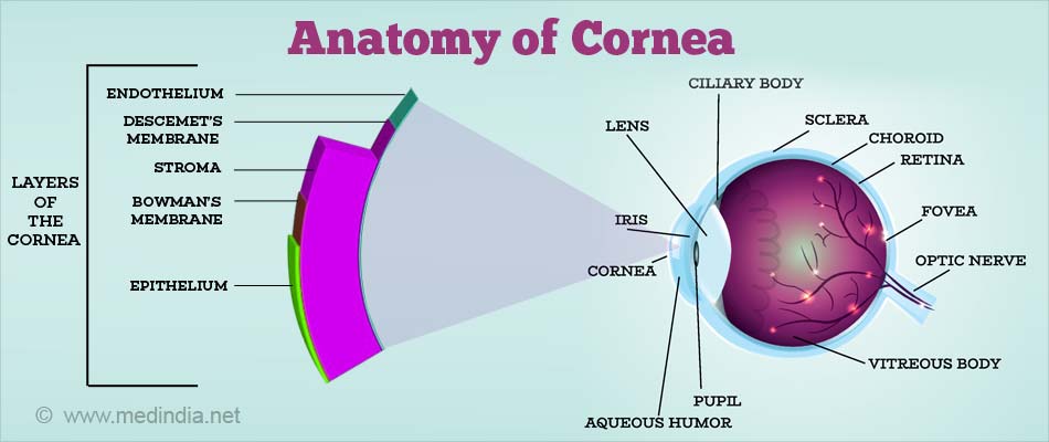 Corneal Transplantation