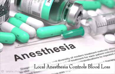 Local Anesthesia Reduces Blood Loss Local Anesthesia Reduces Blood Loss