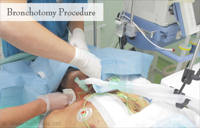 Bronchotomy Surgical Procedure Bronchotomy Surgical Procedure