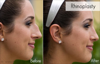 Cosmetic Procedures Cosmetic Procedures