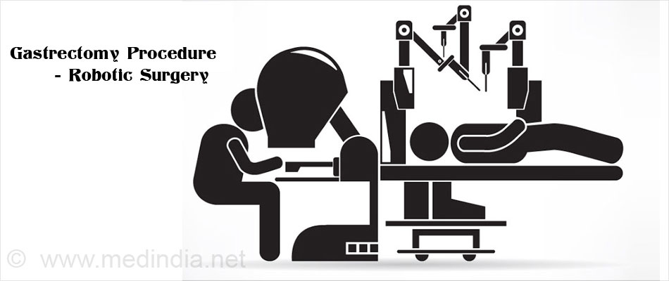 Gastrectomy Procedure - Robotic Surgery Gastrectomy Procedure - Robotic Surgery