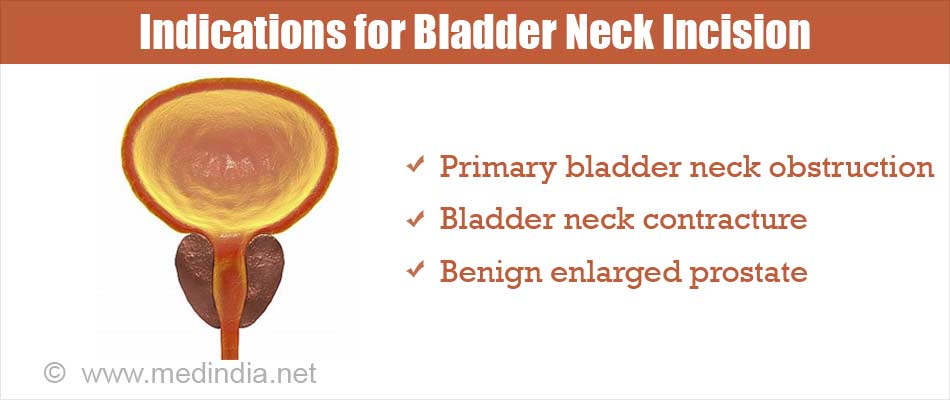 Bladder neck cancer treatment. Magnézium-kiegészítők alkalmazása a platina kemoterápia során