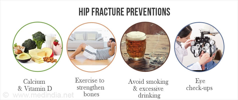 Hip Fracture Preventions Hip Fracture Preventions