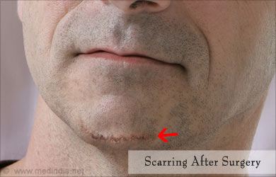 Risk Associated with Plastic Surgery Risk Associated with Plastic Surgery