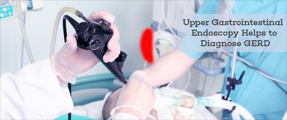 Upper Gastrointestinal Endoscopy Helps to Diagnose GERD Upper Gastrointestinal Endoscopy Helps to Diagnose GERD
