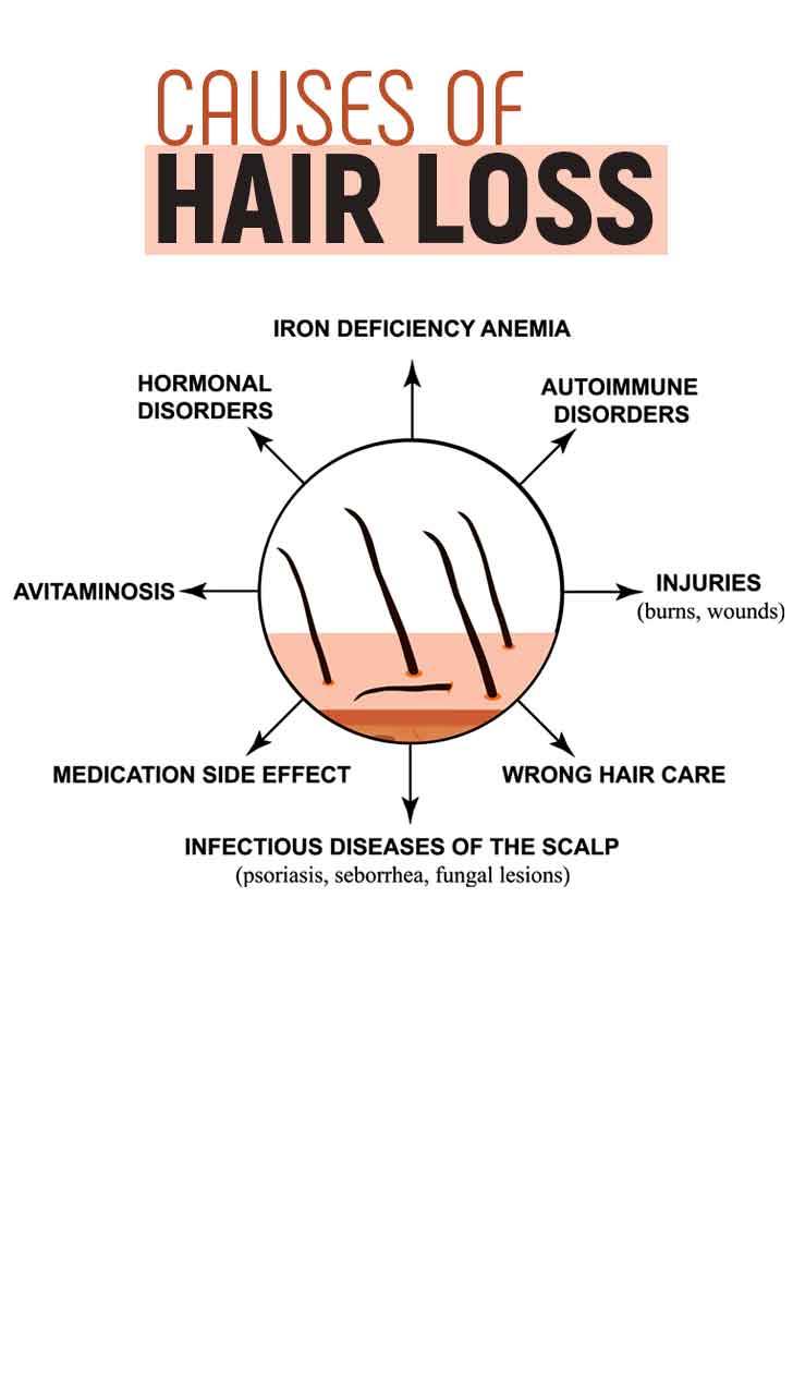 Mysteries of Hair Fall