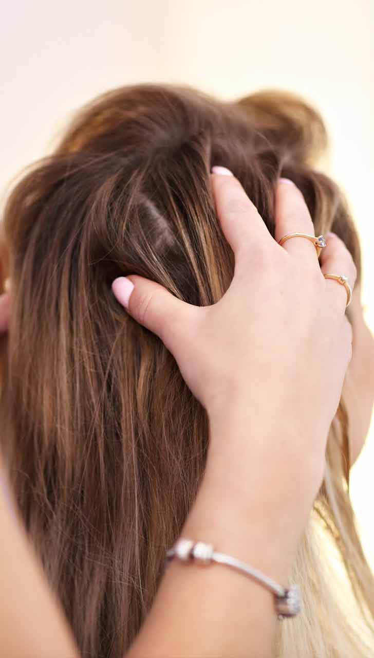 Preventing Hair Loss from Excessive Scalp Oil
