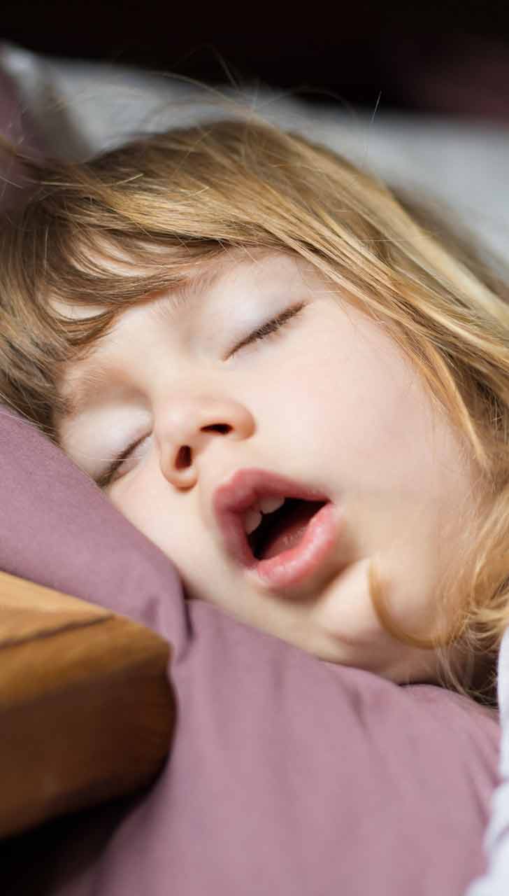 Sleep-Disordered Breathing in Children